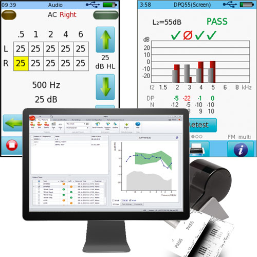 Audiometry and DPOAE screening results with MIRA PC report