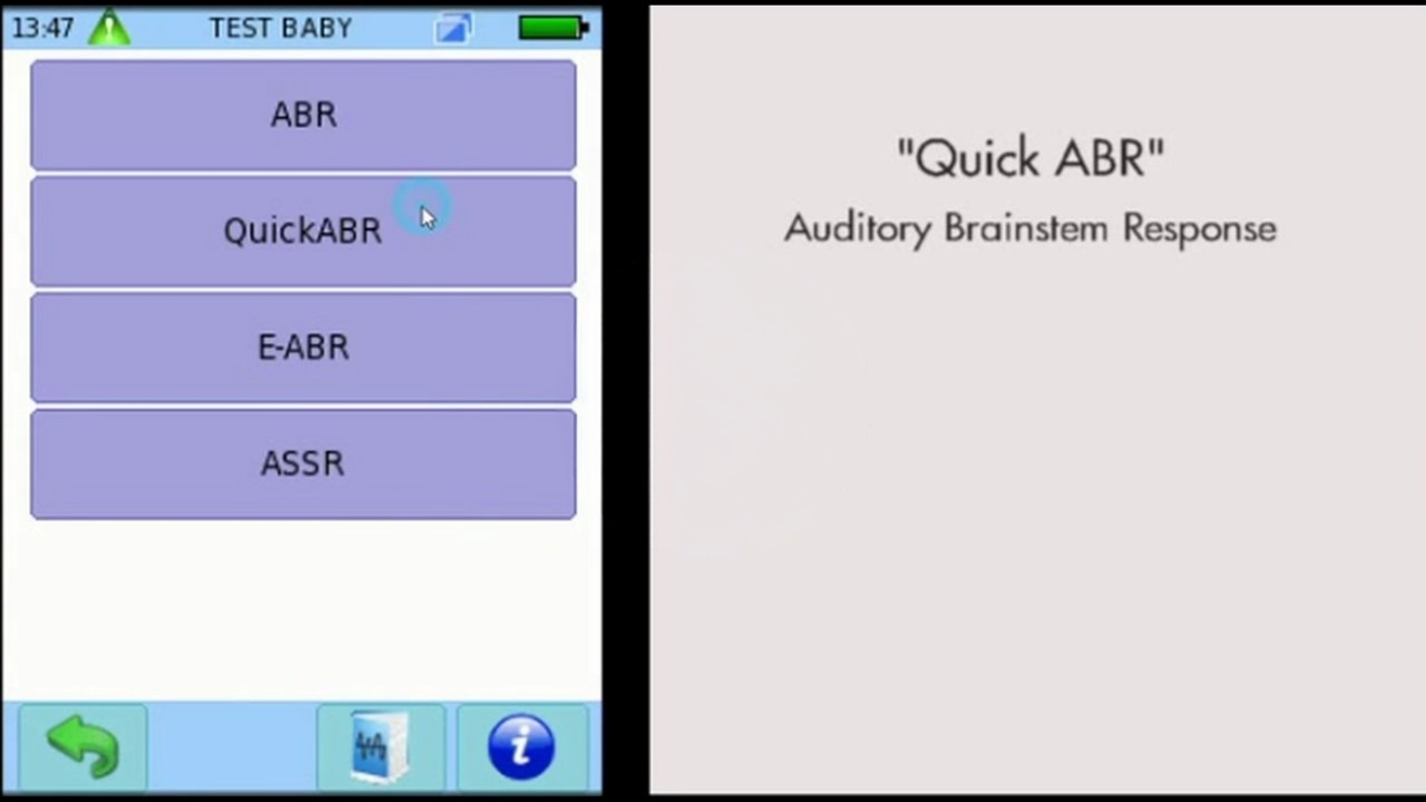 How to configure AABR for neonatal screening on the SENTIERO ADVANCED