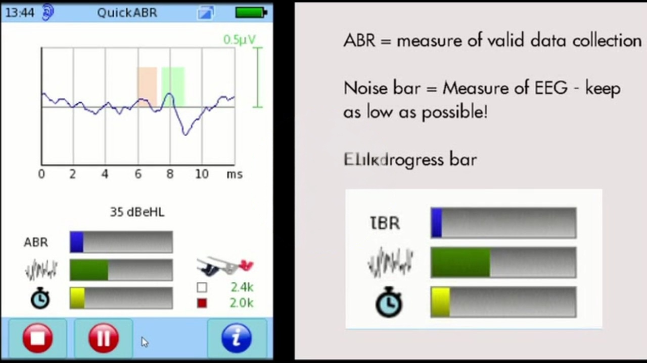 How to run the AABR test for neonatal screening on the SENTIERO ADVANCED