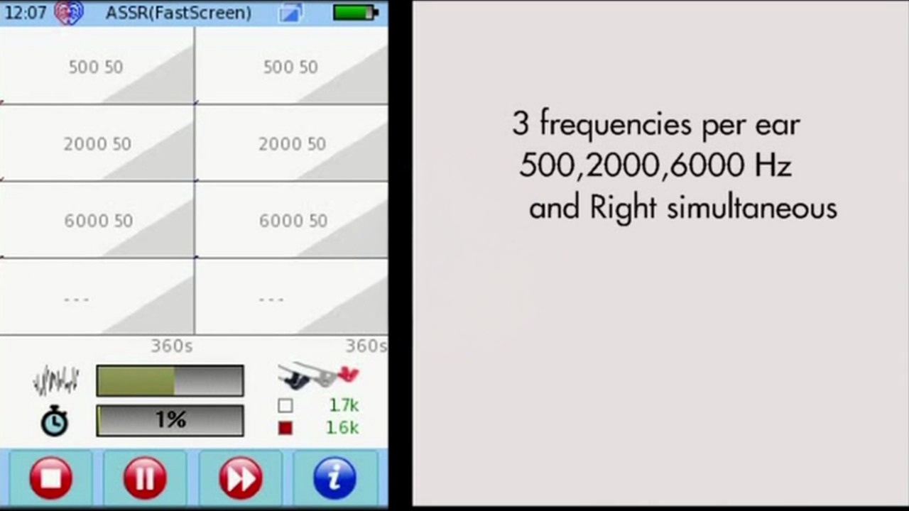 ASSR Screening on the SENTIERO ADVANCED