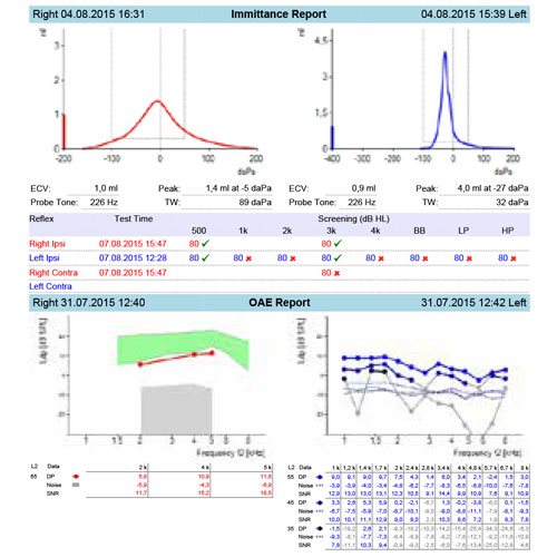 Imagen de la función «SENTIERO TYMP DIAGNOSTIC»